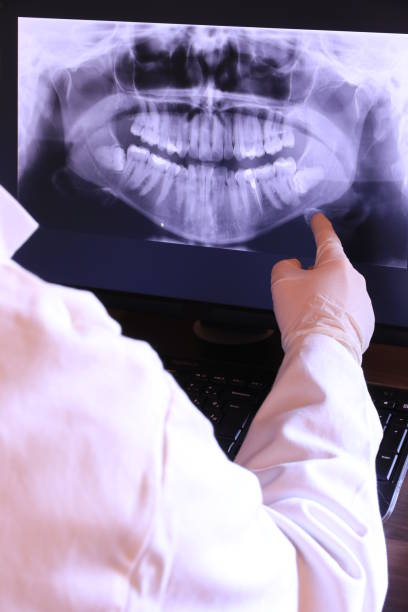 Best Emergency Wisdom Tooth Extraction in Booker, TX